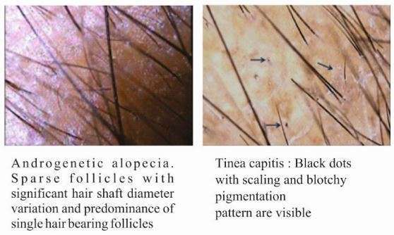 trichology - Ethicare Remedies